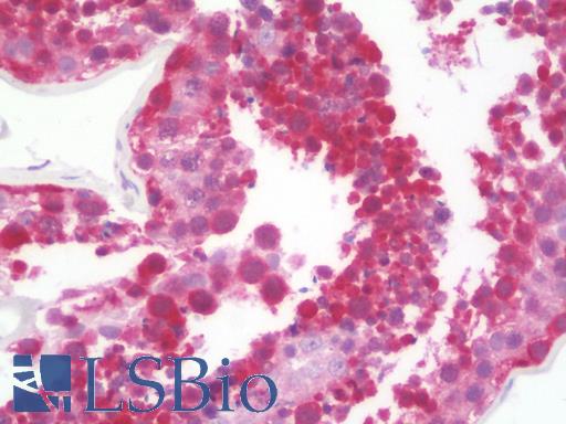 Anti-ABHD2 antibody IHC staining of human testis. Immunohistochemistry of formalin-fixed, paraffin-embedded tissue after heat-induced antigen retrieval. Antibody LS-B9699 concentration 10 ug/ml.