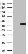 HEK293T cells were transfected with the pCMV6-ENTRY control (Left lane) or pCMV6-ENTRY AMT (Right lane) cDNA for 48 hrs and lysed. Equivalent amounts of cell lysates (5 ug per lane) were separated by SDS-PAGE and immunoblotted with anti-AMT (1:2000).