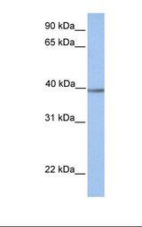 Fetal lung lysate. Antibody concentration: 1.0 ug/ml. Gel concentration: 12%.
