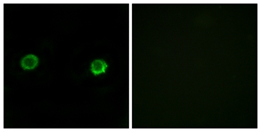 Immunofluorescence of MCF-7 cells, using ABHD2 Antibody. The picture on the right is treated with the synthesized peptide.