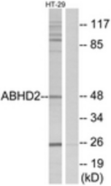 Western blot of extracts from HT29 cells, using ABHD2 Antibody. The lane on the right is treated with the synthesized peptide.