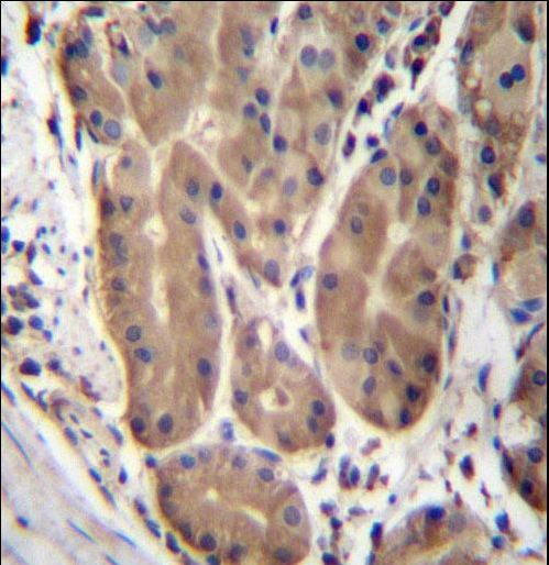 ABHD2 Antibody immunohistochemistry of formalin-fixed and paraffin-embedded human stomach tissue followed by peroxidase-conjugated secondary antibody and DAB staining.