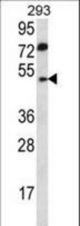 ABHD2 Antibody western blot of 293 cell line lysates (35 ug/lane). The ABHD2 antibody detected the ABHD2 protein (arrow).