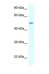AMY2B antibody LS-C145576 Western blot of 721_B Cell lysate. Antibody concentration 1 ug/ml.