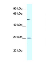 AMY2B antibody LS-C145575 Western blot of Placenta lysate. Antibody concentration 1 ug/ml.