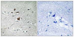 IHC of paraffin-embedded human brain tissue, using APC1 (Ab-355) Antibody. The picture on the right is treated with the synthesized peptide.