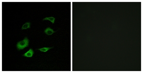 Immunofluorescence of HepG2 cells, using Cyclosome 1 Antibody. The picture on the right is treated with the synthesized peptide.