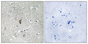 IHC of paraffin-embedded human brain, using APC1 (Phospho-Ser355) Antibody. The sample on the right was incubated with synthetic peptide.