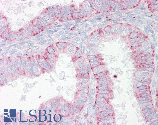 Anti-ABHD4 antibody IHC of human uterus. Immunohistochemistry of formalin-fixed, paraffin-embedded tissue after heat-induced antigen retrieval. Antibody LS-B7686 dilution 10 ug/ml.