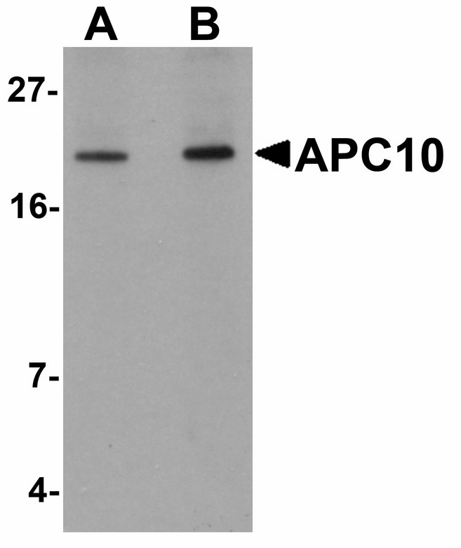 Western blot of APC10 in mouse heart tissue lysate with APC10 antibody at (A) 1 and (B) 2 ug/ml.