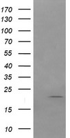HEK293T cells were transfected with the pCMV6-ENTRY control (Left lane) or pCMV6-ENTRY ANAPC11 (Right lane) cDNA for 48 hrs and lysed. Equivalent amounts of cell lysates (5 ug per lane) were separated by SDS-PAGE and immunoblotted with anti-ANAPC11.