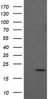 HEK293T cells were transfected with the pCMV6-ENTRY control (Left lane) or pCMV6-ENTRY ANAPC11 (Right lane) cDNA for 48 hrs and lysed. Equivalent amounts of cell lysates (5 ug per lane) were separated by SDS-PAGE and immunoblotted with anti-ANAPC11.