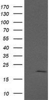 HEK293T cells were transfected with the pCMV6-ENTRY control (Left lane) or pCMV6-ENTRY ANAPC11 (Right lane) cDNA for 48 hrs and lysed. Equivalent amounts of cell lysates (5 ug per lane) were separated by SDS-PAGE and immunoblotted with anti-ANAPC11.