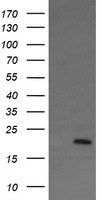 HEK293T cells were transfected with the pCMV6-ENTRY control (Left lane) or pCMV6-ENTRY ANAPC11 (Right lane) cDNA for 48 hrs and lysed. Equivalent amounts of cell lysates (5 ug per lane) were separated by SDS-PAGE and immunoblotted with anti-ANAPC11.