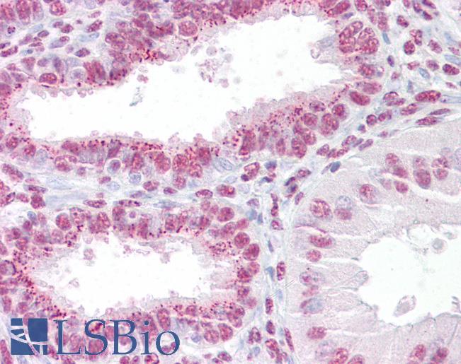 Anti-ANAPC11 / APC11 antibody IHC of human uterus. Immunohistochemistry of formalin-fixed, paraffin-embedded tissue after heat-induced antigen retrieval. Antibody LS-B6980 concentration 5 ug/ml.