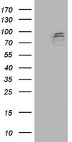 HEK293T cells were transfected with the pCMV6-ENTRY control (Left lane) or pCMV6-ENTRY ANAPC2 (Right lane) cDNA for 48 hrs and lysed. Equivalent amounts of cell lysates (5 ug per lane) were separated by SDS-PAGE and immunoblotted with anti-ANAPC2.