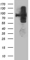 HEK293T cells were transfected with the pCMV6-ENTRY control (Left lane) or pCMV6-ENTRY ANAPC2 (Right lane) cDNA for 48 hrs and lysed. Equivalent amounts of cell lysates (5 ug per lane) were separated by SDS-PAGE and immunoblotted with anti-ANAPC2.