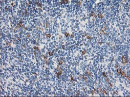 IHC of paraffin-embedded Human lymphoma tissue using anti-ANAPC2 mouse monoclonal antibody.
