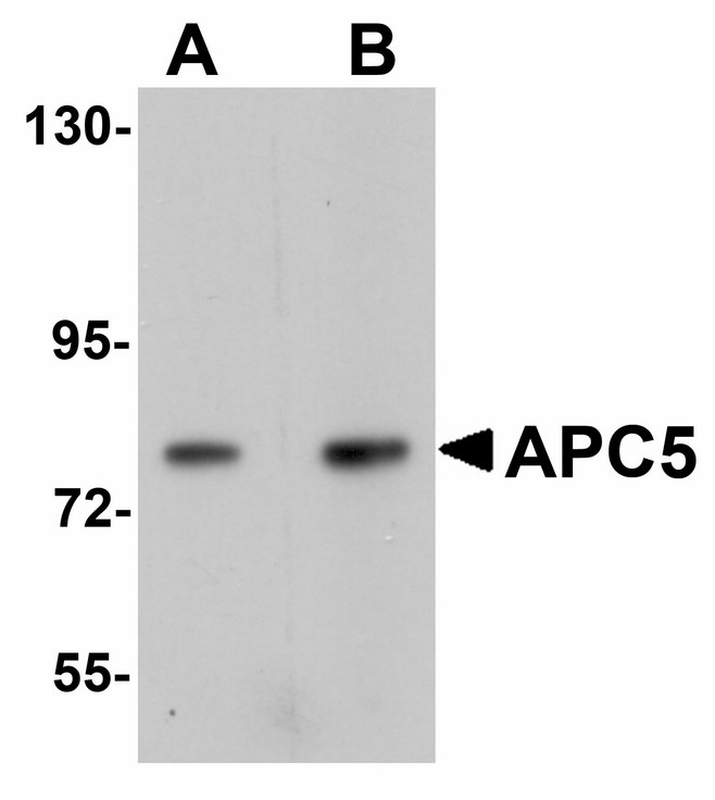 Western blot of APC5 in human kidney tissue lysate with APC5 antibody at (A) 1 and (B) 2 ug/ml.