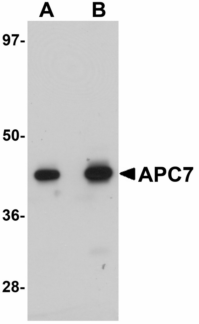 Western blot of APC7 in rat kidney tissue lysate with APC7 antibody at (A) 1 and (B) 2 ug/ml.