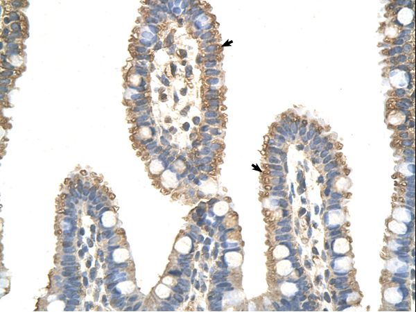 ANAPC7 / APC7 antibody LS-C30519 was used in IHC to stain formalin-fixed, paraffin-embedded human intestine.