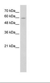 Jurkat Cell Lysate