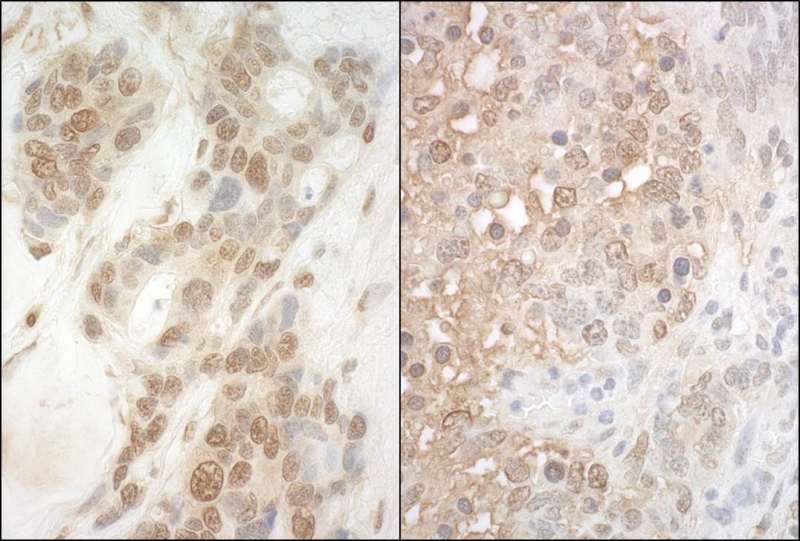 Detection of Human and Mouse APC7 by Immunohistochemistry. Sample: FFPE section of human ovarian carcinoma (left) and mouse teratoma (right). Antibody: Affinity purified rabbit anti-APC7 used at a dilution of 1:1000 (1 ug/ml).