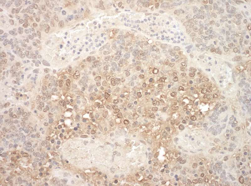 Detection of Mouse APC7 by Immunohistochemistry. Sample: FFPE section of mouse teratoma. Antibody: Affinity purified rabbit anti-APC7 used at a dilution of 1:250.
