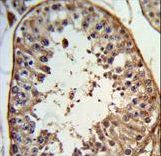Formalin-fixed and paraffin-embedded human testis tissue reacted with ANGEL1 Antibody , which was peroxidase-conjugated to the secondary antibody, followed by DAB staining. This data demonstrates the use of this antibody for immunohistochemistry; clinical relevance has not been evaluated.