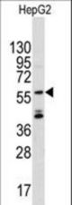 Western blot of anti-ANGEL2 antibody in CEM cell line lysates (35 ug/lane). ANGEL2 (arrow) was detected using the purified antibody.