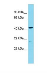 Western blot of Human Placenta. ANGEL2 antibody dilution 1.0 ug/ml.