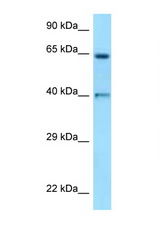 ANGPT1 / Angiopoietin-1 antibody LS-C146240 Western blot of ACHN Cell lysate. Antibody concentration 1 ug/ml.
