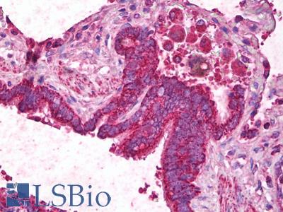Anti-ANGPT1 / Angiopoietin-1 antibody IHC of human lung, respiratory epithelium. Immunohistochemistry of formalin-fixed, paraffin-embedded tissue after heat-induced antigen retrieval. Antibody LS-B6867 concentration 2.5 ug/ml.
