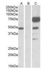 HEK293 lysate (10 ug protein in RIPA buffer) overexpressing Human ANGPT1 with DYKDDDDK tag probed with ANGPT1 antibody (1 ug/ml) in Lane A and probed with anti-DYKDDDDK Tag (1/1000) in lane C. Mock-transfected HEK293 probed with ANGPT1 antibody (1 mg/ml) in Lane B. Primary incubations were for 1 hour. Detected by chemiluminescence.