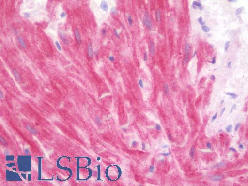 Anti-ABHD6 antibody IHC staining of human prostate. Immunohistochemistry of formalin-fixed, paraffin-embedded tissue after heat-induced antigen retrieval. Antibody LS-B9707 concentration 10 ug/ml.