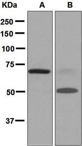 Western blot analysis on (A) fetal heart and (B) human plasma lysates using anti-ANGPTL4 antibody.