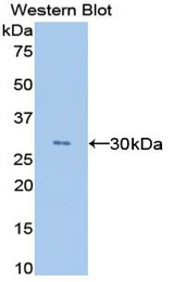 Western blot of recombinant ANGPTL4.