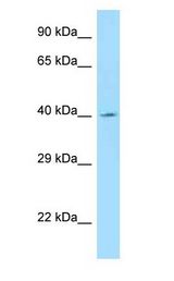 ANGPTL5 antibody Western Blot of MCF7.