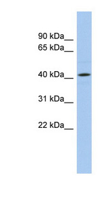 ANGPTL5 antibody LS-C102690 Western blot of HeLa lysate.