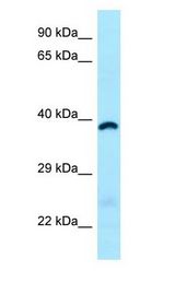 ABHD6 antibody Western Blot of Fetal Heart.