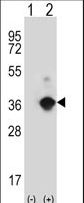 Western blot of ANGPTL7 (arrow) using rabbit polyclonal ANGPTL7 Antibody. 293 cell lysates (2 ug/lane) either nontransfected (Lane 1) or transiently transfected (Lane 2) with the ANGPTL7 gene.