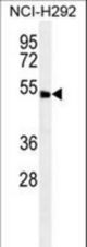 ABHD8 Antibody western blot of NCI-H292 cell line lysates (35 ug/lane). The ABHD8 antibody detected the ABHD8 protein (arrow).