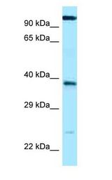 ANHX antibody Western Blot of ACHN.