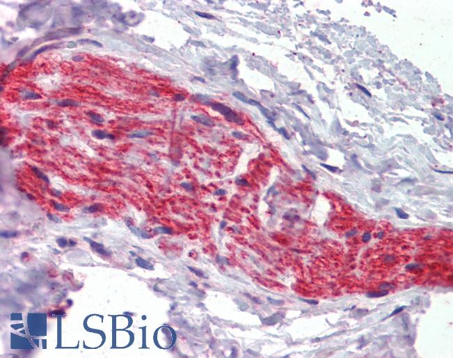 Anti-ANK3 antibody IHC of human prostate. Immunohistochemistry of formalin-fixed, paraffin-embedded tissue after heat-induced antigen retrieval. Antibody LS-B3842 concentration 3.75 ug/ml.