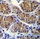 ANKRD5 Antibody immunohistochemistry of formalin-fixed and paraffin-embedded human stomach tissue followed by peroxidase-conjugated secondary antibody and DAB staining.