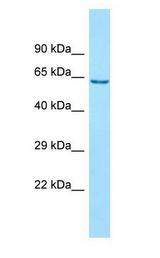 ANKFY1 antibody Western Blot of 721_B.