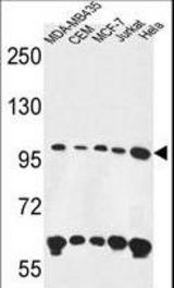 ANKFY1 Antibody western blot of MDA-MB435,CEM,MCF-7,Jurkat,HeLa cell line lysates (35 ug/lane). The ANKFY1 antibody detected the ANKFY1 protein (arrow).