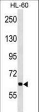 ANKHD1 Antibody western blot of HL-60 cell line lysates (35 ug/lane). The ANKHD1 antibody detected the ANKHD1 protein (arrow).