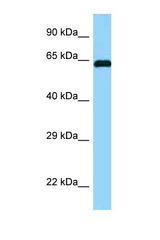 ABI1 antibody LS-C146169 Western blot of Fetal Brain lysate. Antibody concentration 1 ug/ml.