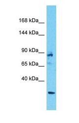 Western blot of ANKRD17 Antibody with human 293T Whole Cell lysate.